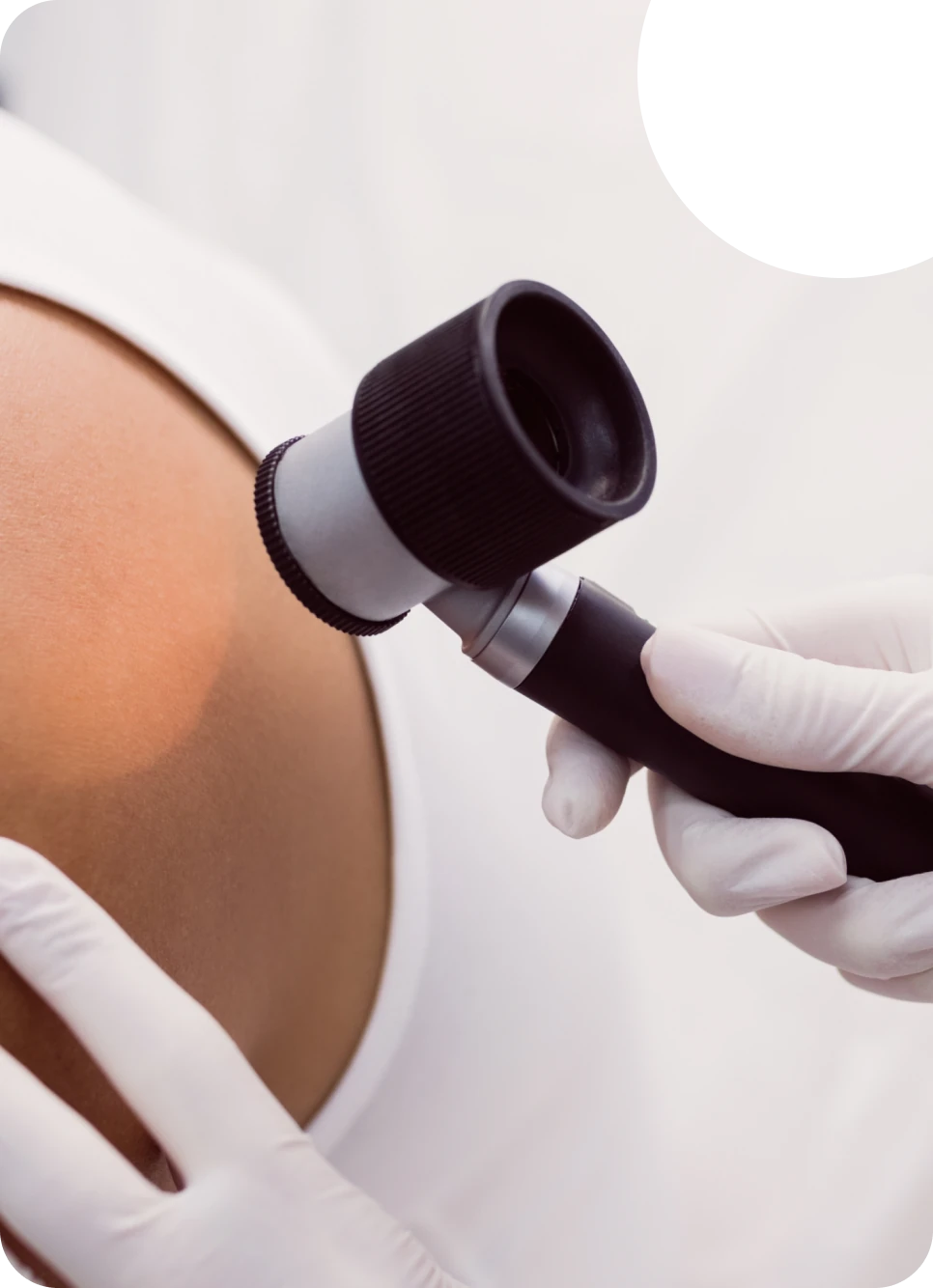 A dermatoscope being used to inspect a patient’s skin.