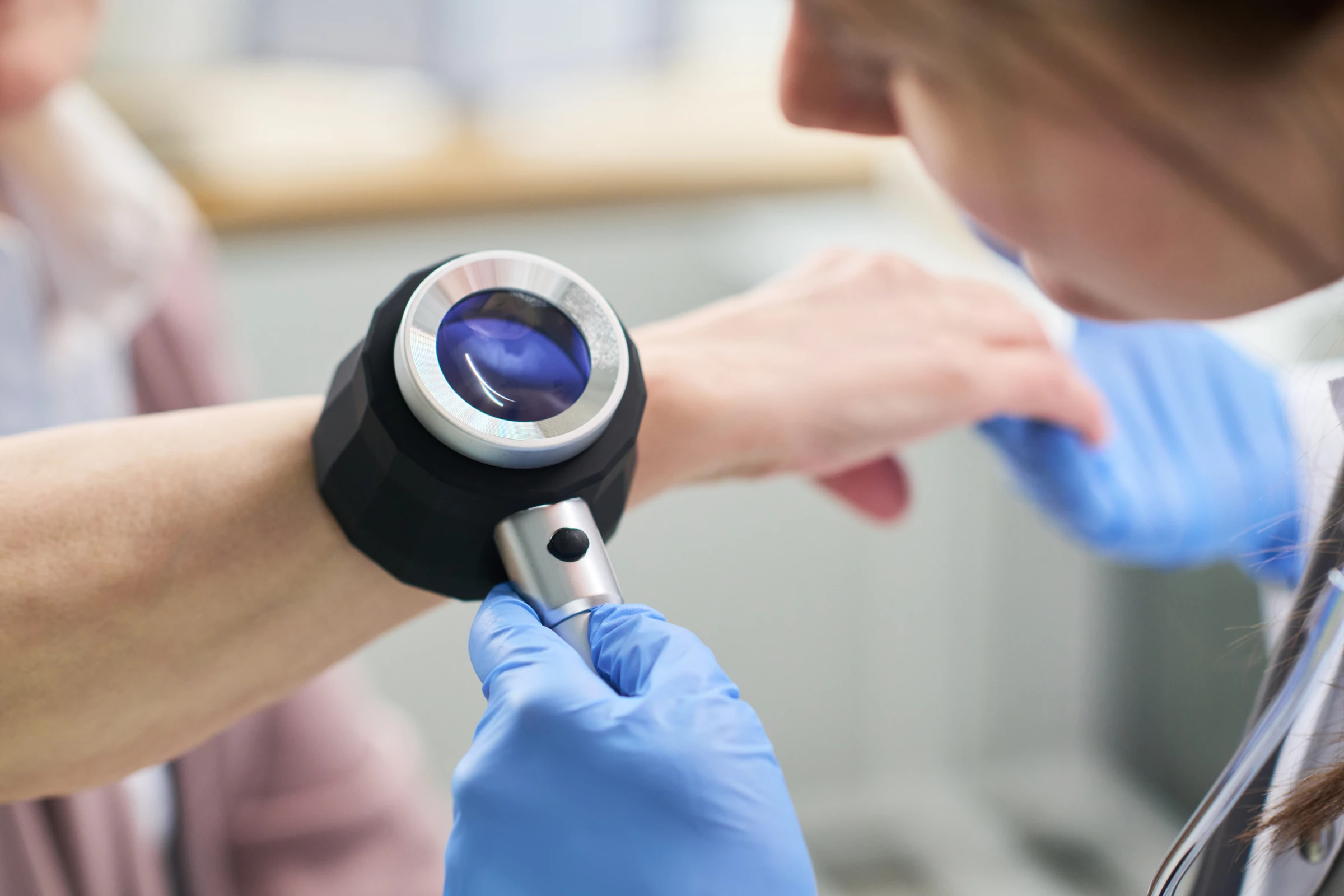 A clinician examining a patient’s arm with a dermatoscope.