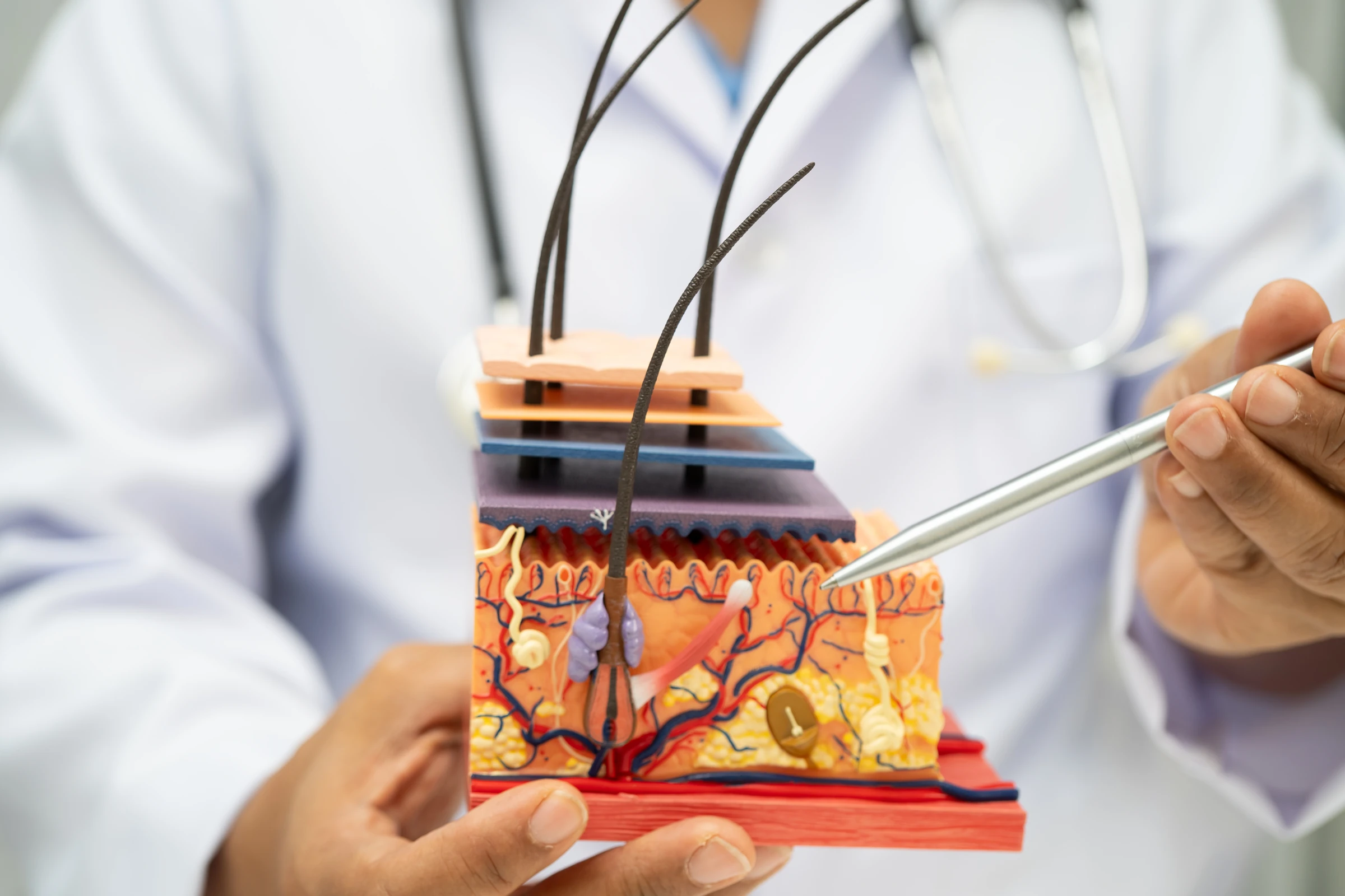 A clinician explaining the layers of the skin using an anatomical model.